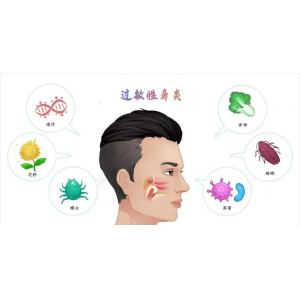 銘仁耳鼻喉專家分享：如何一招解決過敏性鼻炎的打噴嚏流鼻涕！