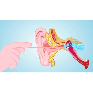 分泌性中耳炎，一個不流膿，但不可忽視的聽力殺手