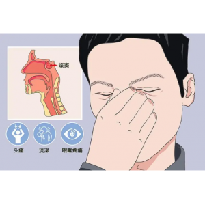 頭疼、眼痛雖小，卻可能是蝶竇炎發(fā)出的警告信號！