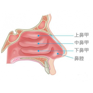 鼻甲肥大會引起面部結(jié)構(gòu)變化，還會導(dǎo)致眼袋、黑眼圈？