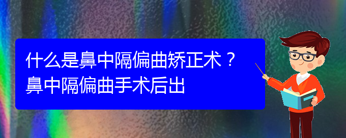 (貴陽鼻科醫(yī)院掛號(hào))什么是鼻中隔偏曲矯正術(shù)？ 鼻中隔偏曲手術(shù)后出(圖1)