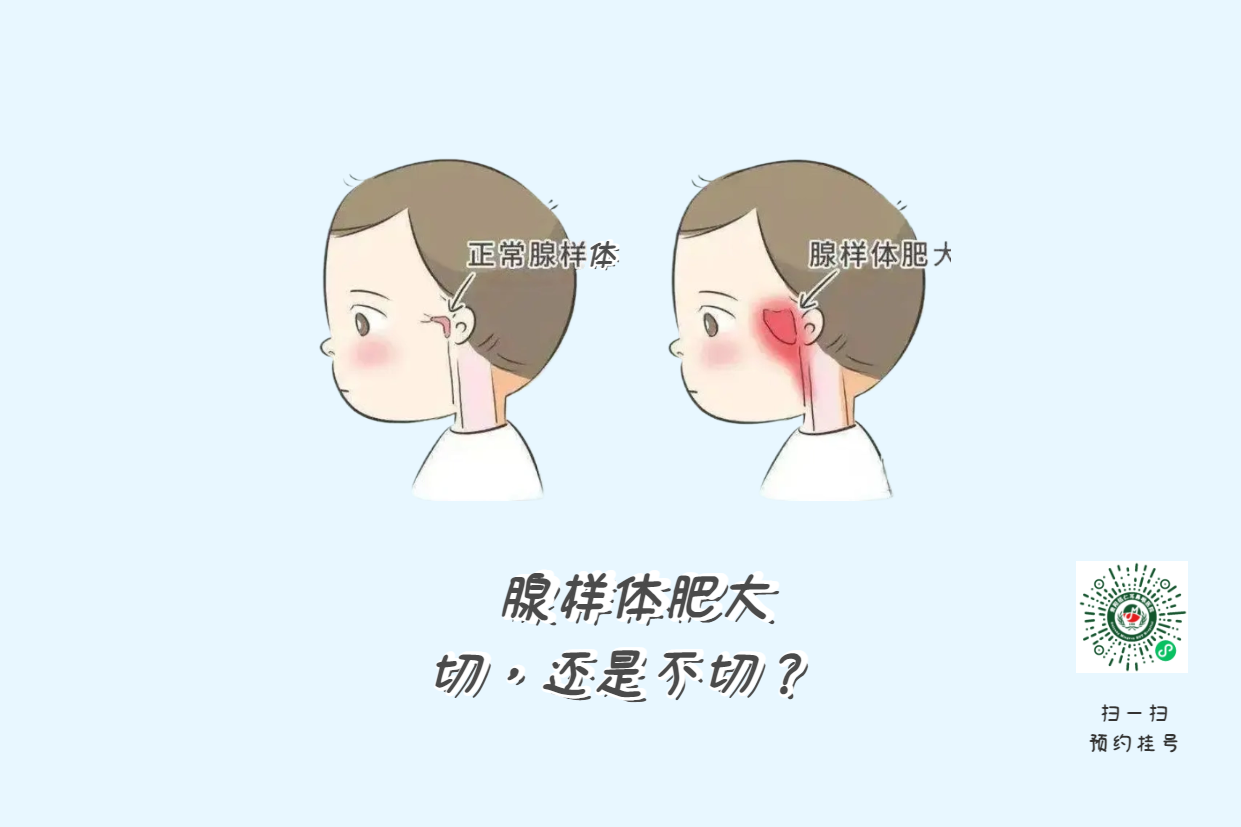 暑假來了，孩子腺樣體肥大到底切不切？(圖1)