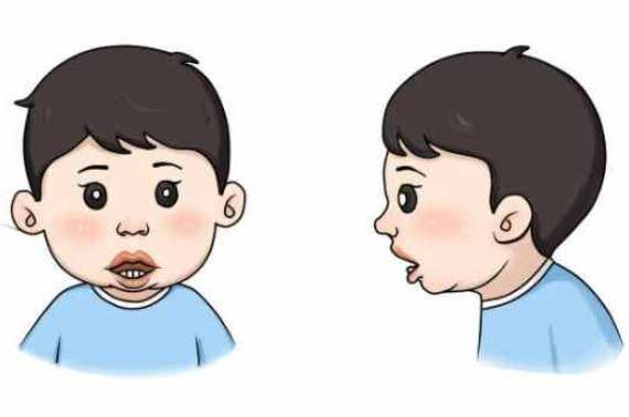 專家分享：父母注意！孩子腺樣體肥大如果忽略，后果很嚴(yán)重！(圖2)