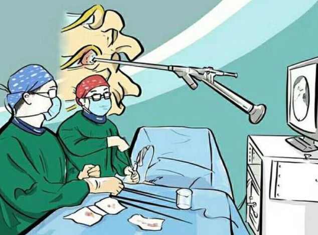 咽喉炎若不及時(shí)治療，可能會(huì)引發(fā)一系列并發(fā)癥(圖3)