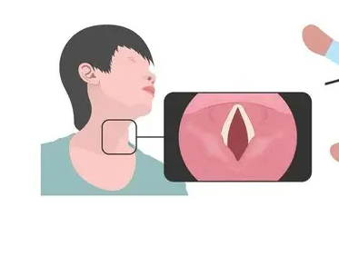 耳鼻喉分享：嘶啞聲不一定是上火，要警惕這些疾??！(圖3)