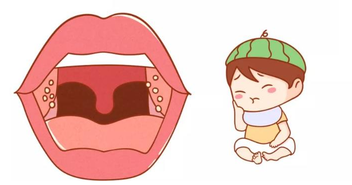 切除扁桃體會(huì)對(duì)身體產(chǎn)生危害嗎？(圖3)
