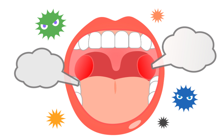 咽部不適、刺激性干咳，注意可能舌扁桃體肥大在作祟(圖2)