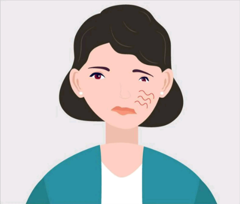 中耳炎會引起面癱，是真的嗎？(圖3)