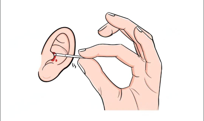 得了外耳道濕疹，怎么辦，快試試這三個(gè)方法(圖2)