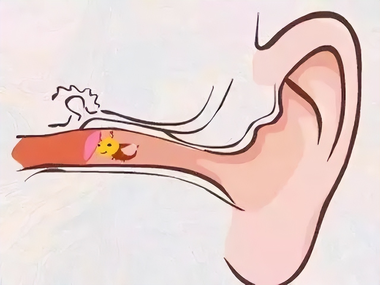 耳鳴耳聾，千萬別大意，勿讓小病變大病(圖2)