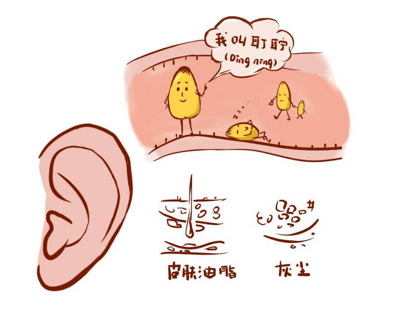 耳朵里有耳屎要不要掏？耳屎多，到底該咋辦？(圖2)