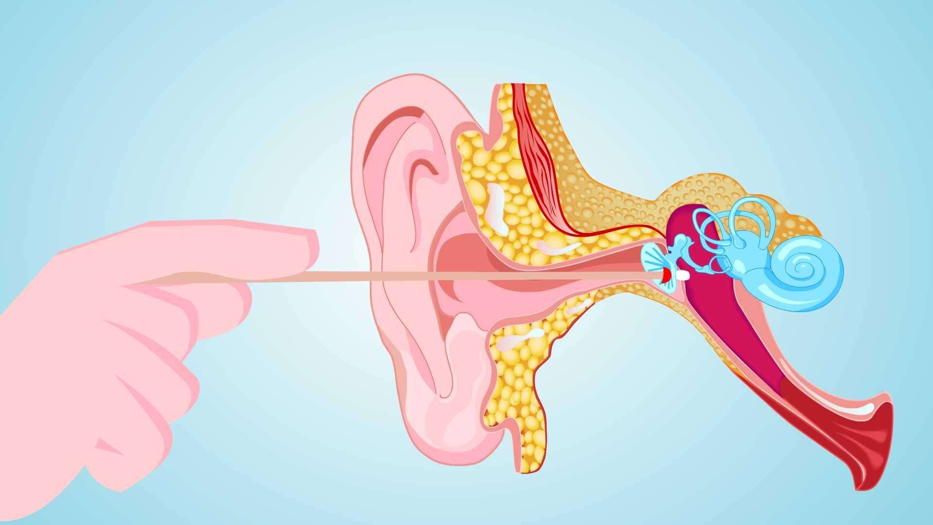 耳朵流膿、耳痛、聽力下降？中耳炎及時治療會怎樣？(圖1)