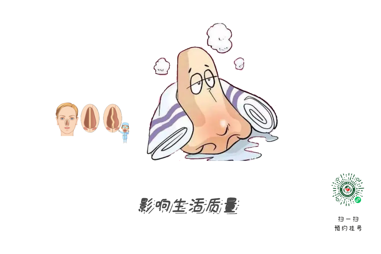 鼻塞、流涕、打噴嚏，是鼻炎引起的？注意可能是鼻中隔偏曲！(圖2)