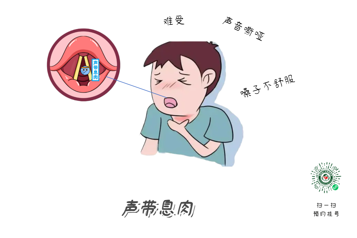 聲音嘶啞，喉部不適怎么辦？怎么預(yù)防？(圖1)