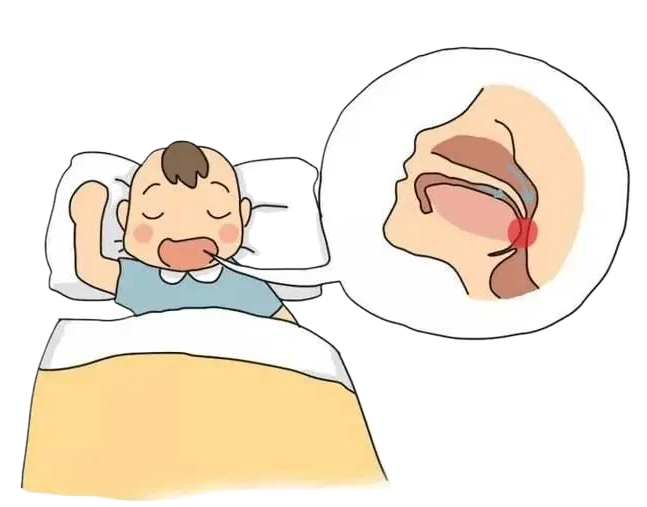 腺樣體手術(shù)風(fēng)險(xiǎn)大嗎？麻醉會(huì)影響孩子智商嗎？(圖2)