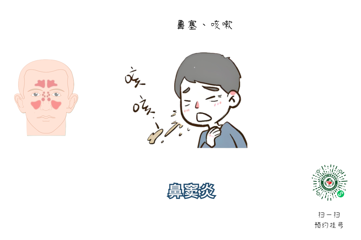 鼻炎、鼻竇炎傻傻分不清，兩者該如何區(qū)分？(圖2)
