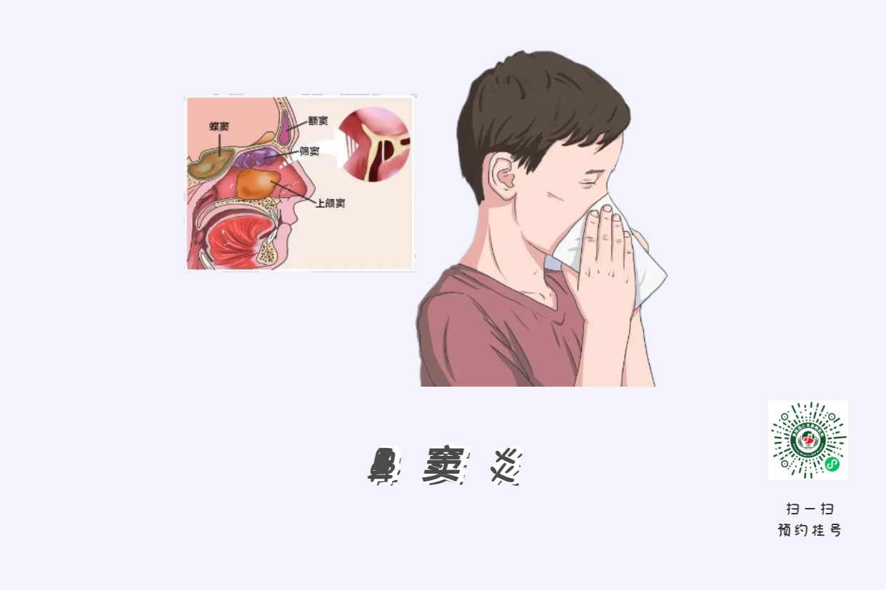 鼻竇炎頭痛有特點(diǎn)！這個(gè)位置痛要當(dāng)心(圖3)