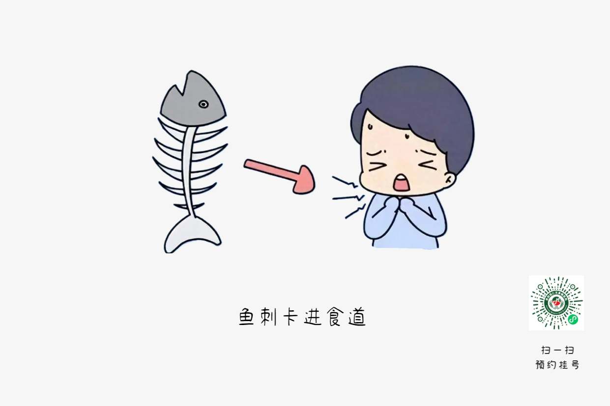 魚刺卡喉時(shí)，你的“土方法”可能讓情況更危險(xiǎn)(圖1)