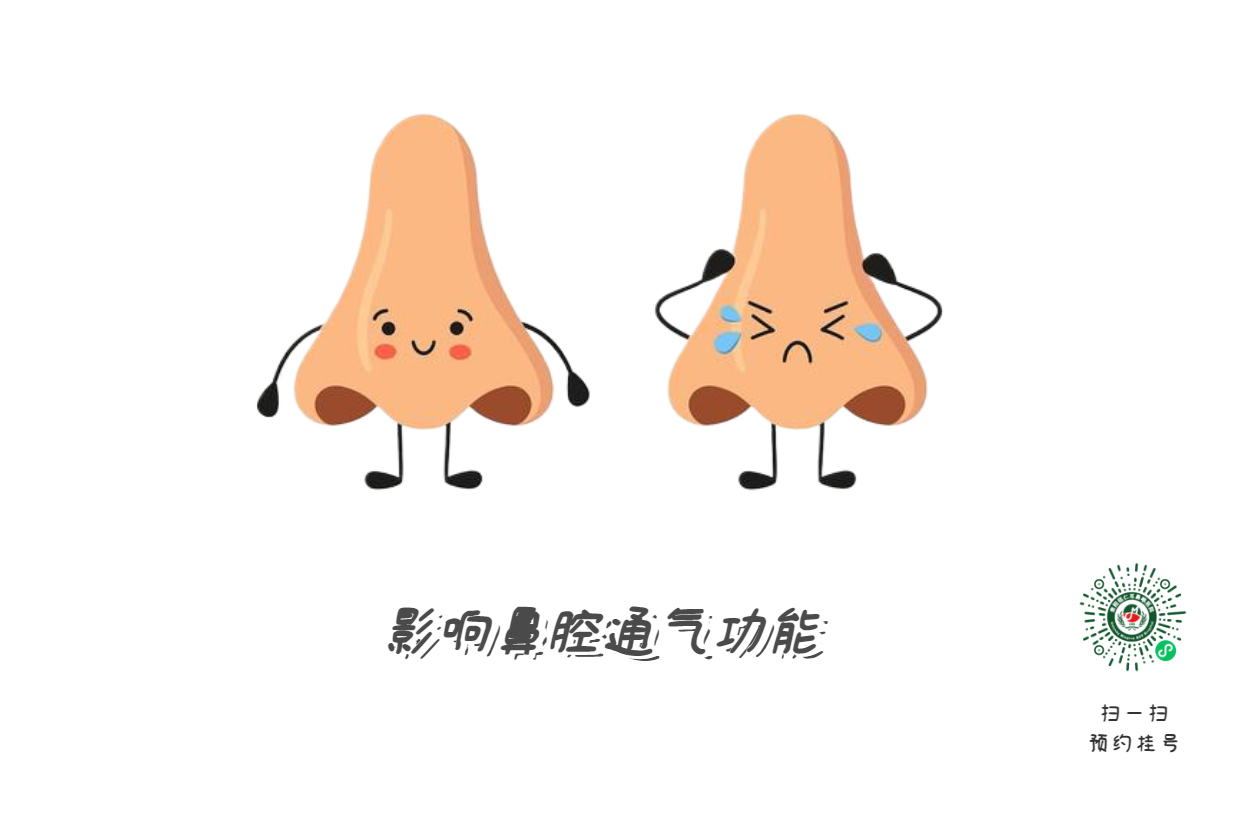 鼻中隔偏曲必須手術(shù)？符合這標(biāo)準(zhǔn)再?zèng)Q定(圖2)