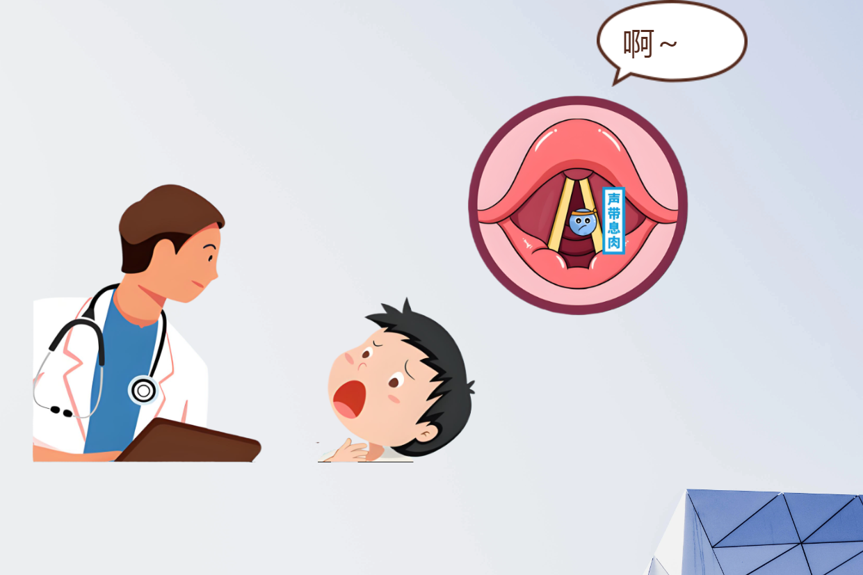 長期清嗓子？可能是聲帶息肉早期信號(圖2)