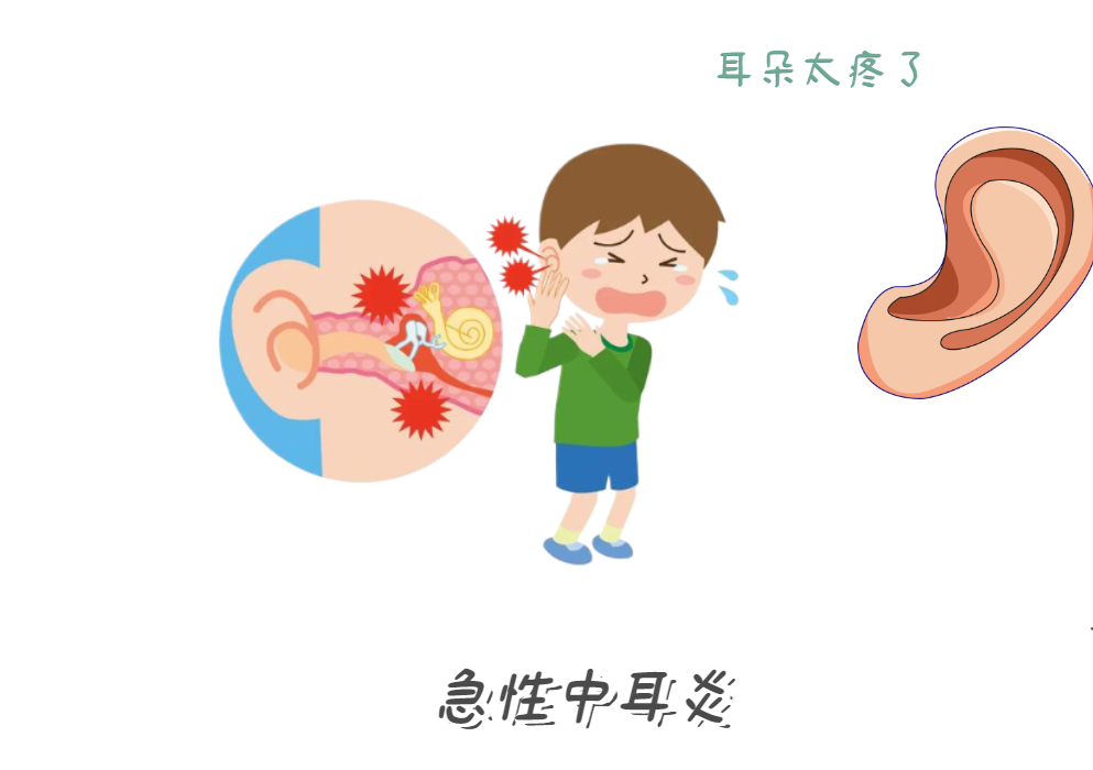 耳朵痛到睡不著？急性中耳炎急救法！(圖1)