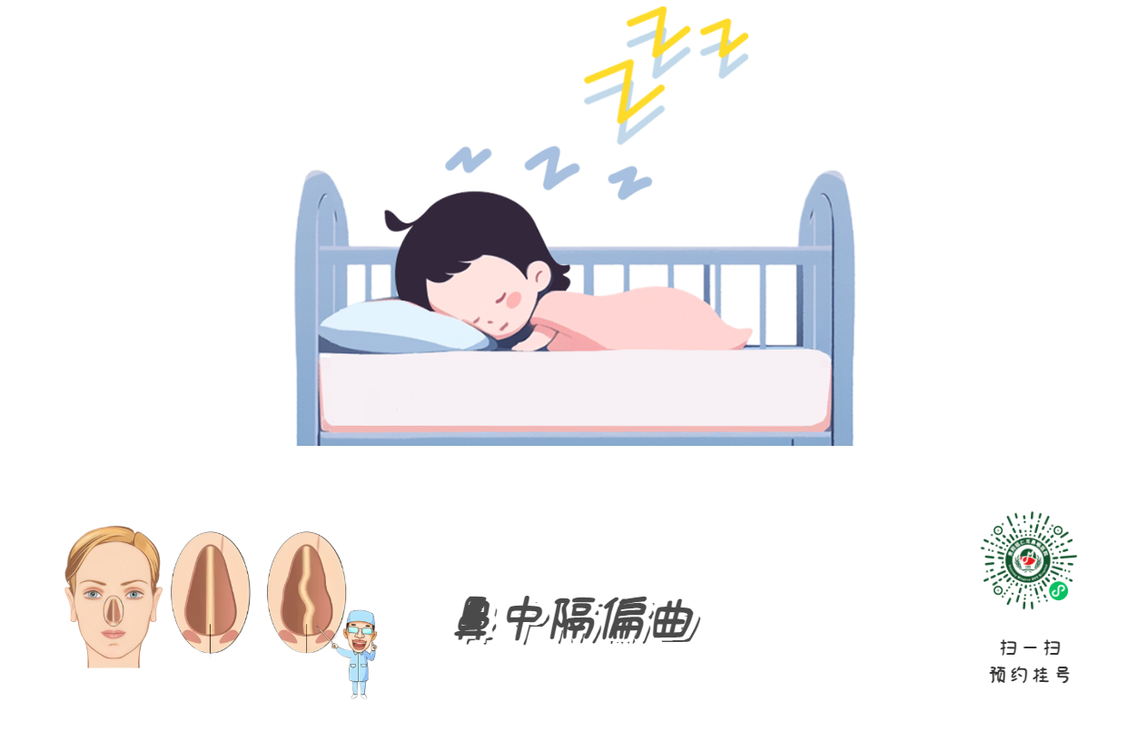 孩子打呼=睡得香？腺樣體警報(bào)！(圖3)