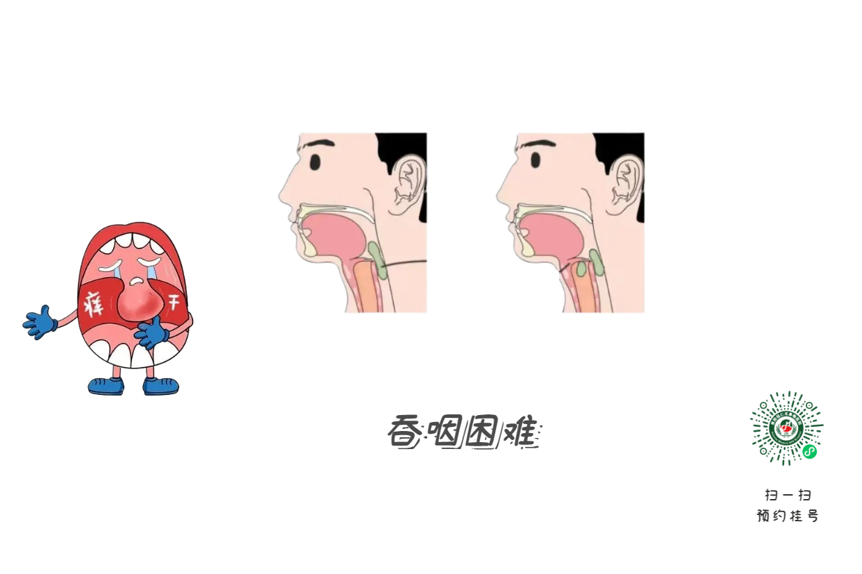 嗓子啞了別大意，可能是聲帶在“報(bào)警”(圖2)