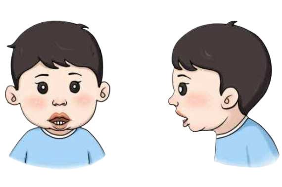 腺樣體影響智力？研究結(jié)果嚇壞家長(圖2)